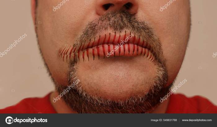 Horror Shot Scary Strange Man Mouth Sewn Shut Stock Photo by ©borjomi88 ... How to wrap an ankle